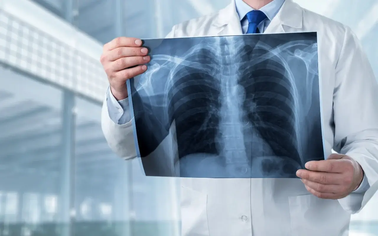 Kenntnisse im Strahlenschutz Röntgen